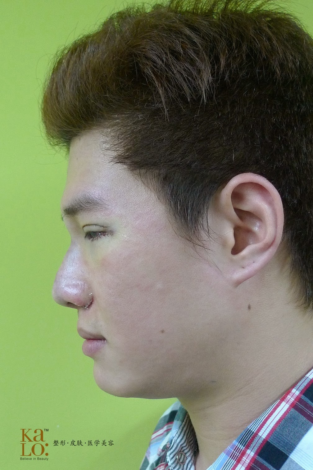 【Vic张祖诚歌手整形日记】Chapter 2:蝴蝶美丽蜕变 —时尚型男隆重登场! 1 image1 副本