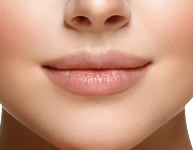 Lip Filler Injection Malaysia - Dermal Filler 6 ideal candidates02