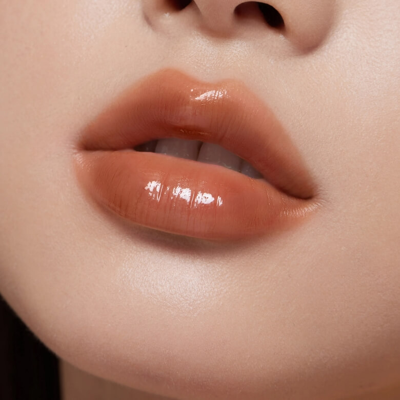 Lip Filler Injection Malaysia - Dermal Filler 2 sculpting01