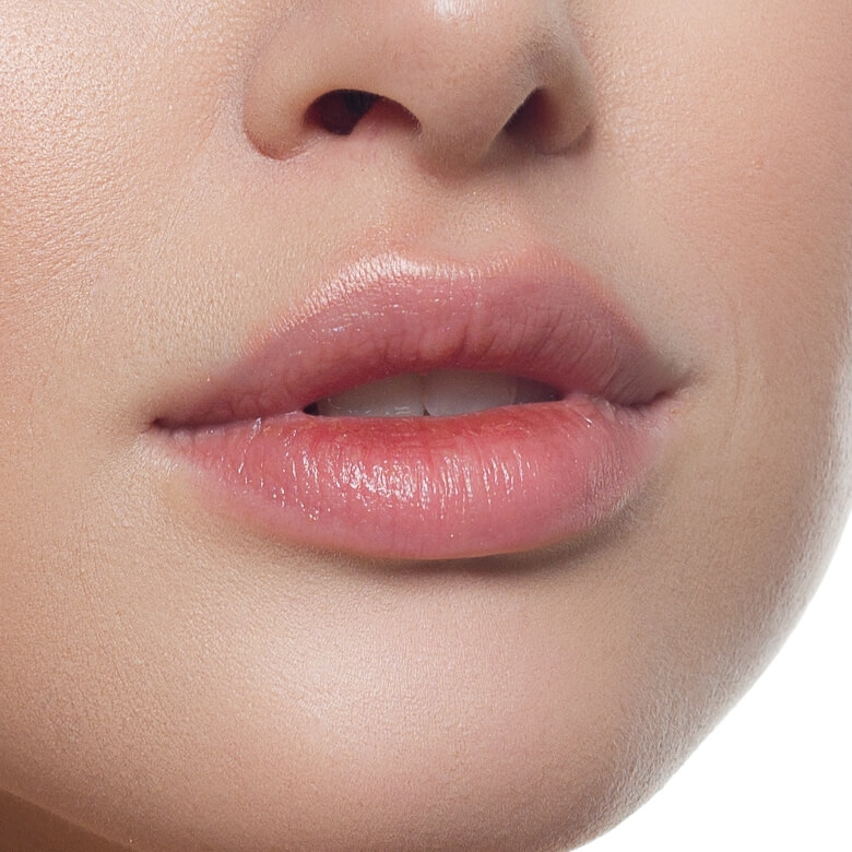 Lip Filler Injection Malaysia - Dermal Filler 3 sculpting02