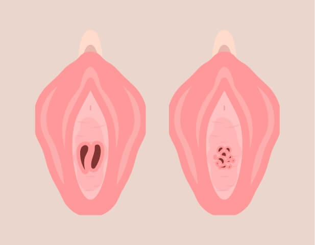 why02