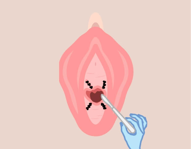 why03