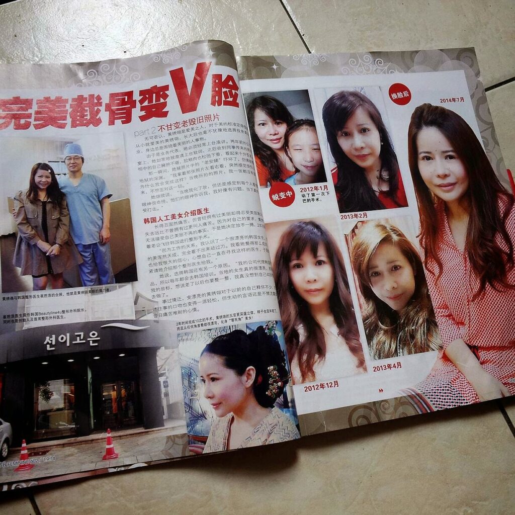【安娣整形日记:变身逆龄美魔女!】 Chapter 6:整形后心情 :一切都是值得的! 5 109207