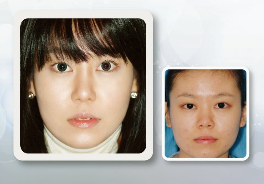 Beautyline4U Korea整形外科院长崔胜皓医生 9 A