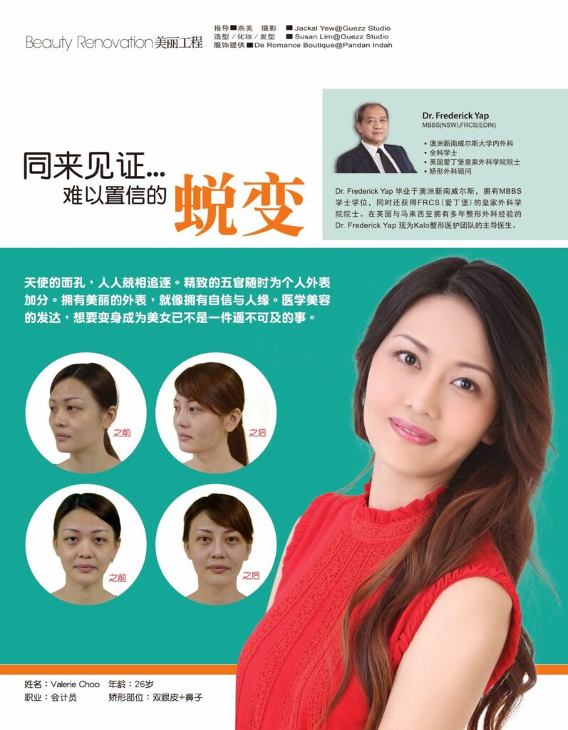 给自己一双迷人韩式双眼皮 Non-Surgical Double Eyelid 1 Ad 20140217 595 1