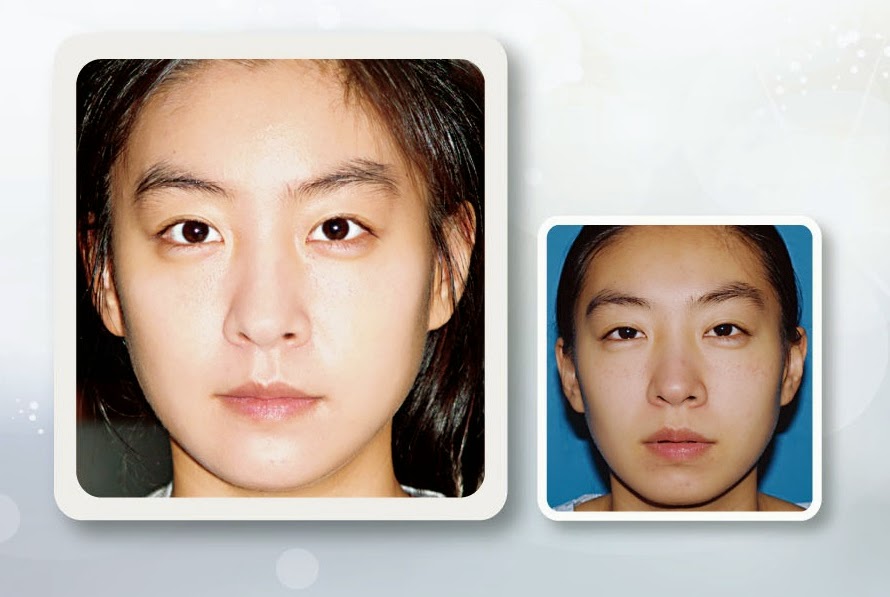 Beautyline4U Korea整形外科院长崔胜皓医生 8 B