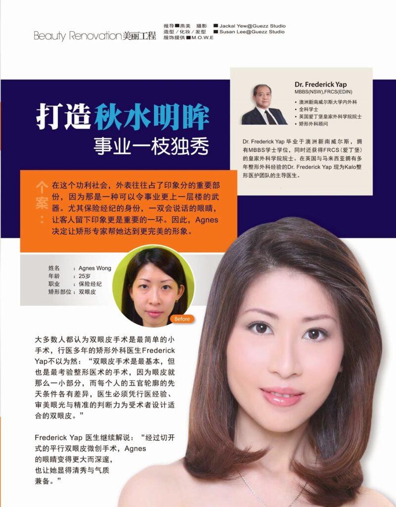 跟单眼皮说再见 晋升大眼妹行列! 1 KALO Feminine ad for 20 Jan 2013 revised 5 crop