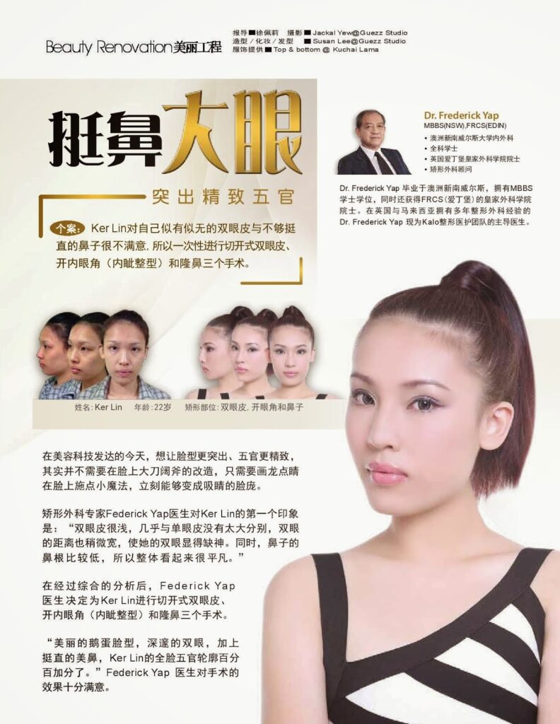 平凡五官华丽蜕变 轮廓立体分明 1 Ker Lin