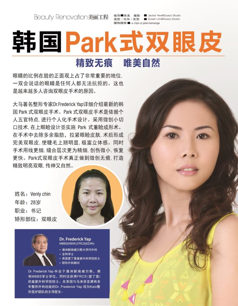 韩国Park式双眼皮 动人眼神令人着迷 1 Venly 2