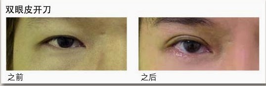 超自然迷人深邃双眼皮 这个新年当个电眼美人! 4 de 1