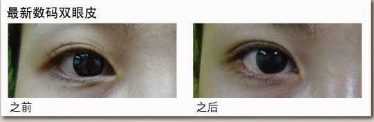 超自然迷人深邃双眼皮 这个新年当个电眼美人! 5 de 3