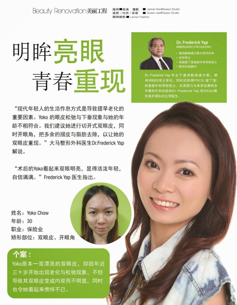 告别松弛下垂眼皮 重现青春活力神采! 5 yoko chow