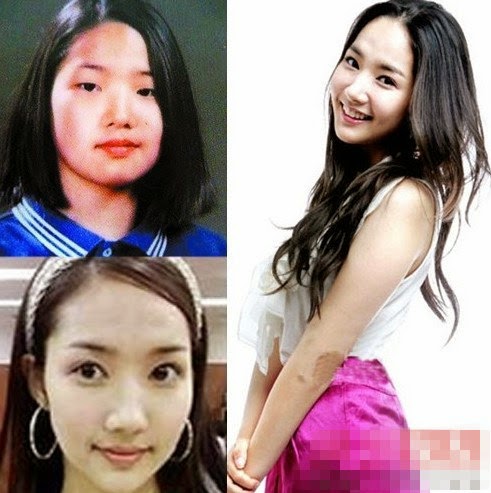 十个一整容就大红的明星 你知道有哪些吗? 7 扑