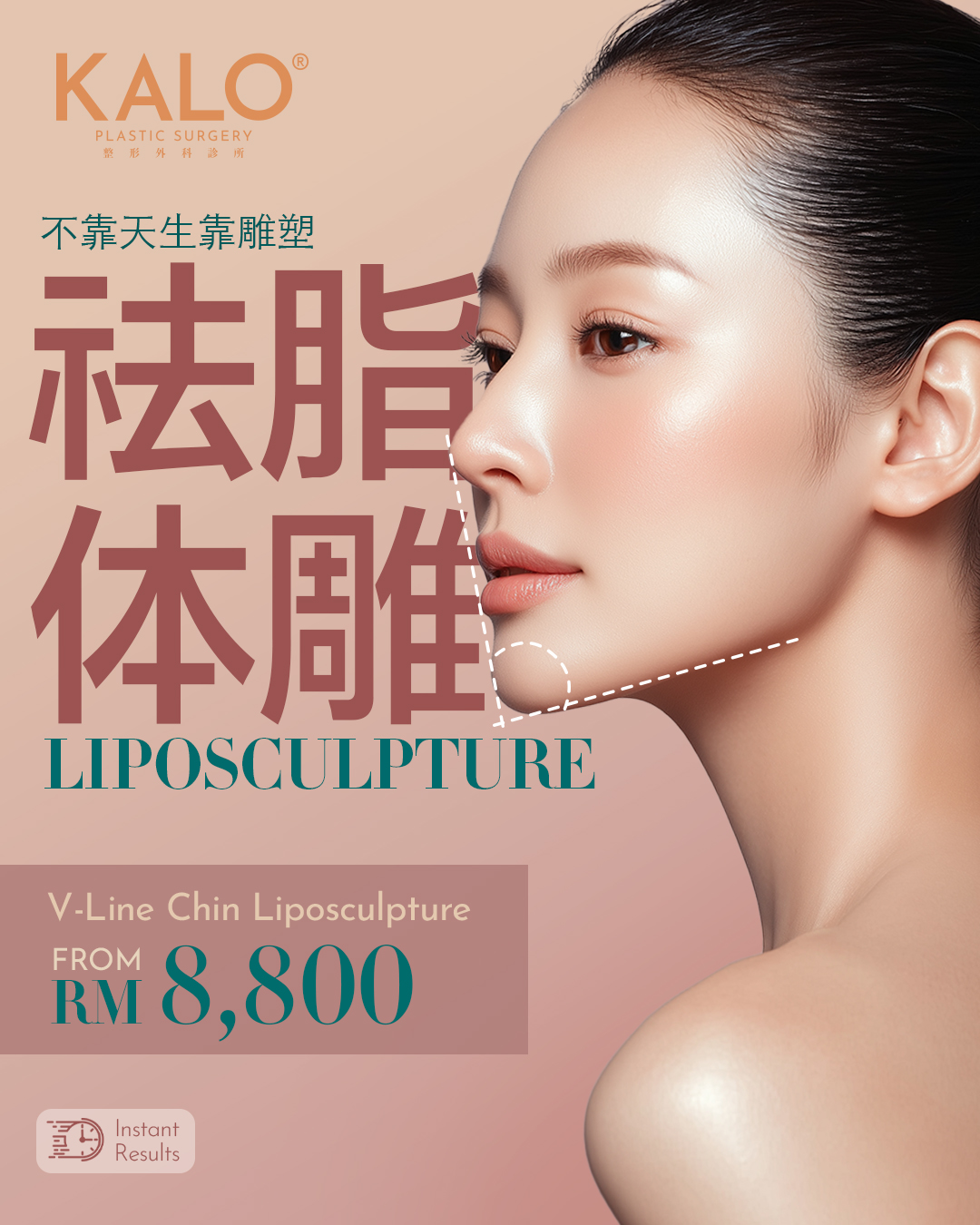 Chin Lipo