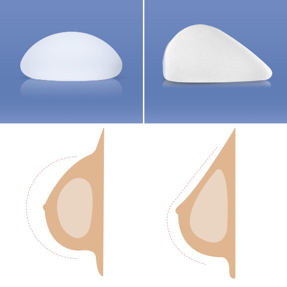 product memoryshape sm 2 2 0