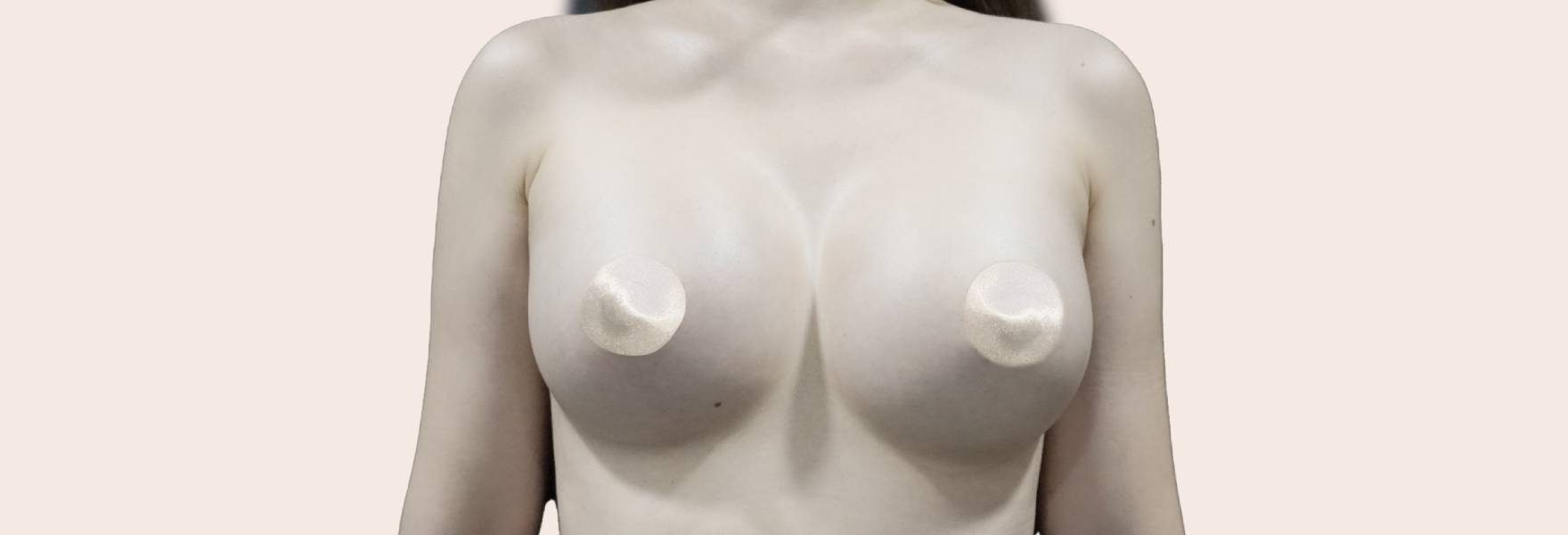 compare-breast-augmentation-after
