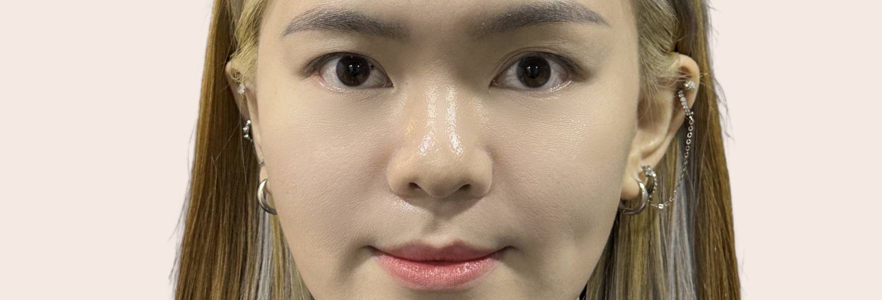 compare-filler-after