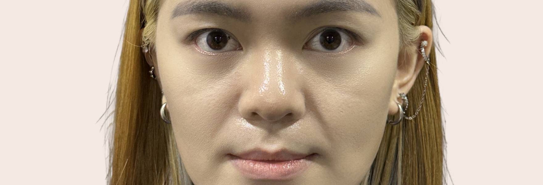 compare-filler-before