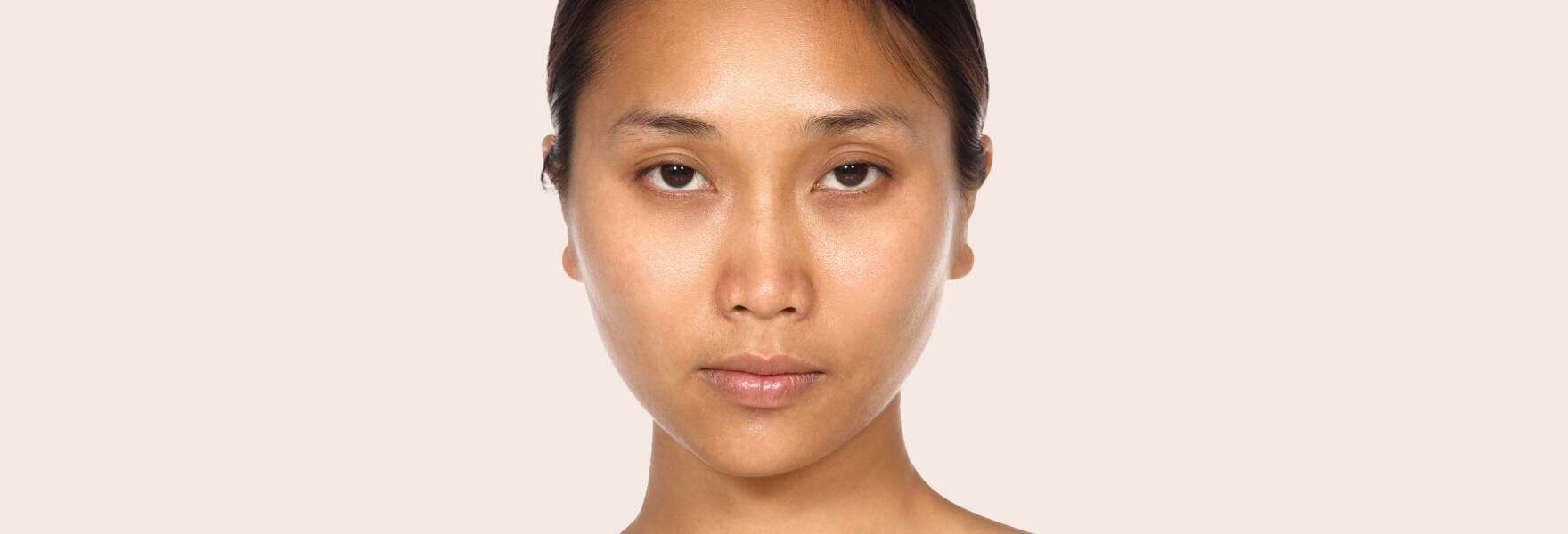 compare-whitening-before